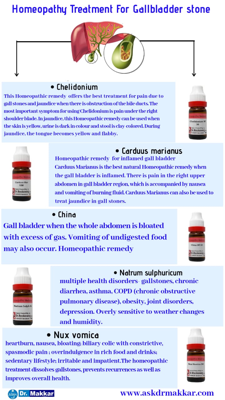 Doctor Recommended Homeopathy Medicines For Gallstone 53 OFF
